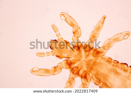 The head louse (Pediculus humanus capitis) is a parasite Live on the body, person or animal and live by sucking blood into food.
