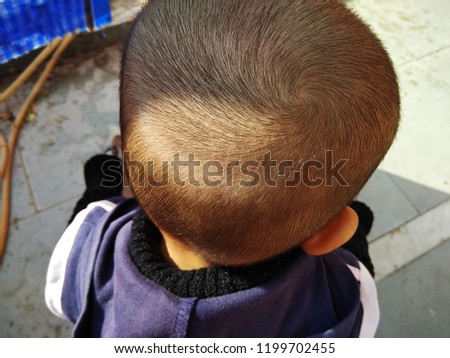 The Head and Scalp of Eight months old child. Newly grown hair on the head of eight months old child after Mundan Sanskar,a tradition in Hinduism to cut the hair of Newly born child first time. 