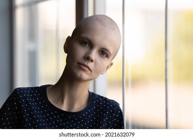 Head Shot Portrait Of Young Millennial Woman With Shaved Head Suffering From Oncological Disease. Cancer Patient Taking Chemotherapy, Radiotherapy Against Leukemia, Brain Tumor, Fighting For Life