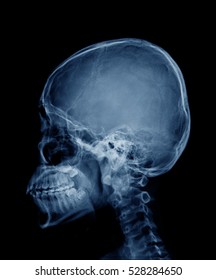 Head Skull X-ray Side View In Blue Tone