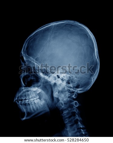 head skull x-ray side view in blue tone