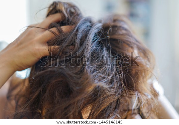 Head Unkempt Woman Itchy Scalp Hair Stock Photo Edit Now 1445146145