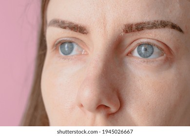 Healing Of Permanent Eyebrow Makeup. Skin Restoration. High Quality Photo