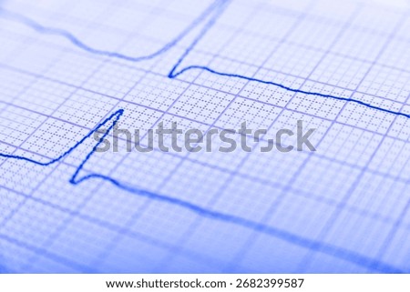 Health care background of Electrocardiogram plot