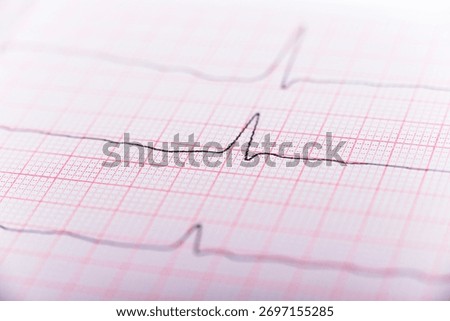 Health care background of Electrocardiogram plot