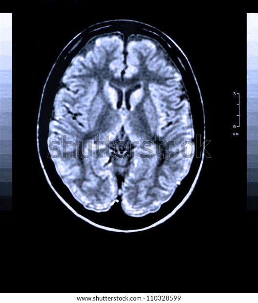 Health Medical Image Mri Mra Magnetic Stock Photo (Edit Now) 110328599