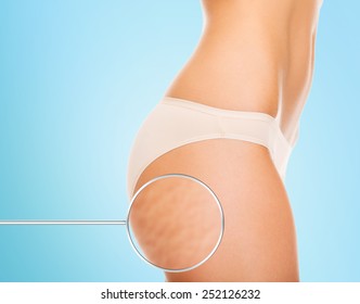 health, people, bodycare and beauty concept - close up of woman buttocks with cellulite and magnifier over blue background - Shutterstock ID 252126232