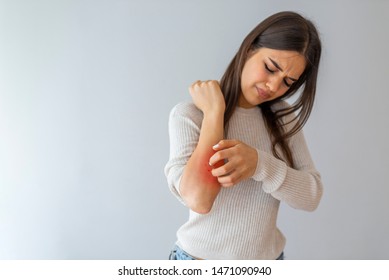 Health problem, skin diseases. Young woman scratching her itchy arm with allergy rash. Woman scratching her arm. Woman scratching arm indoors, space for text. Allergy symptoms