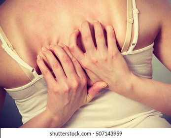 Health Problem, Skin Diseases. Young Woman Scratching Her Itchy Back With Allergy Rash