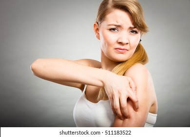 Health Problem, Skin Diseases. Young Woman Scratching Her Itchy Arm With Allergy Rash