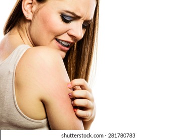 Health Problem. Young Woman Scratching Her Itchy Arm With Allergy Rash