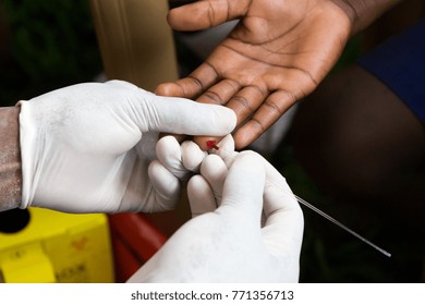 A Health Worker Doing A Finger Prick Test For HIV. He Is Drawing Blood Into A Capillary Tube After Pricking The Patient With A Lancet. Photo Taken In Uganda In 2017.