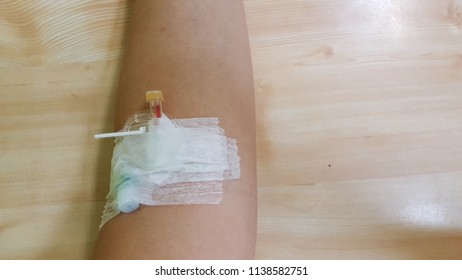 Healthcare Equipment For Glucose Tolerance Test On Pregnant Woman Arm. 