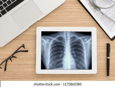 Healthcare And Medical Concept. Lung X-ray Image Of Scan Chest Patient On Digital Tablet Screen.  Top View.