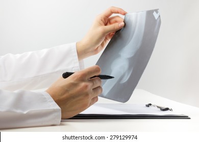 Healthcare and medicine concept - doctor with medical clipboard analyzing leg knee roentgen or x-ray radiography examination 