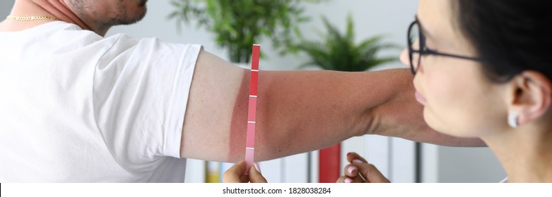 Healthcare professional determines the extent of patient's burn. Sunburn on skin concept - Shutterstock ID 1828038284