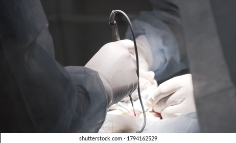 Healthcare workers doing male enhancement surgery. Action. Close up of penis enlargement surgery in operating theater, concept of sex health medicine.