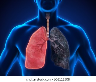 Healthy Lung and Smokers Lung. 3D rendering