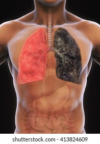 How Smoking Affects The Lungs Comanche County Memorial How Smoking Affects The Lungs Comanche County Memorial