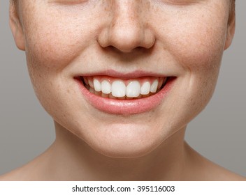 Healthy Smile. Teeth Whitening. Beautiful Smiling Young Woman. Over White Background. Laughing Girl Freckles Face