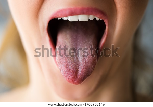 Healthy Woman Mouth
With Clean Tongue Out