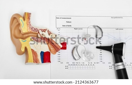 Hearing test concept. Result of hearing exam - audiogram, hearing aids and otoscope on audiologist tablenear anatomical model of auricle, view from above