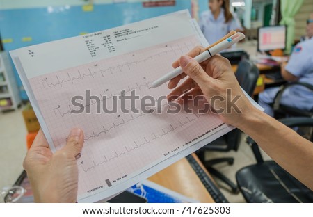 Heart analysis, electrocardiogram graph (ECG) in hand doctor at the hospital .