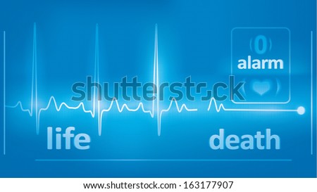 heart beats cardiogram and asystole on the medical monitor