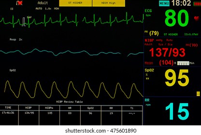 Patient Monitor Displays Vital Signs Ecg Stock Vector (Royalty Free ...