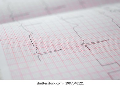 Heart Electrocardiogram EKG Chart On Special Paper. Concept For Heart Scan, Health Insurance, Medical Background, Examination