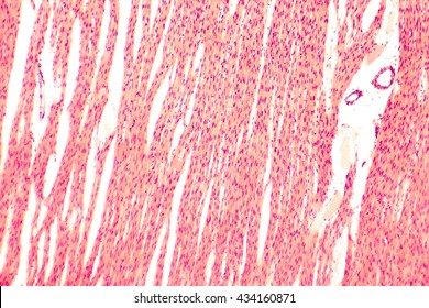 Heart Muscle, Light Micrograph. Striated Cardiac Muscle Cells (myocytes). Light Microscopy, Hematoxilin And Eosin Stain, Magnification 100x