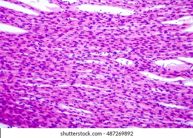 Heart Muscle, Light Micrograph. Striated Cardiac Muscle Cells Myocytes. Light Microscopy, Hematoxilin And Eosin Stain, Magnification 200x