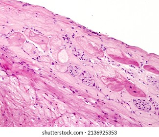 Heart. Purkinje Fibers, Part Of The Conducting System Of The Heart. They Appear As Large Muscle Fibres With Central Nucleus And Few Myofibrils Located In The Subendocardium, Beneath The Endocardium