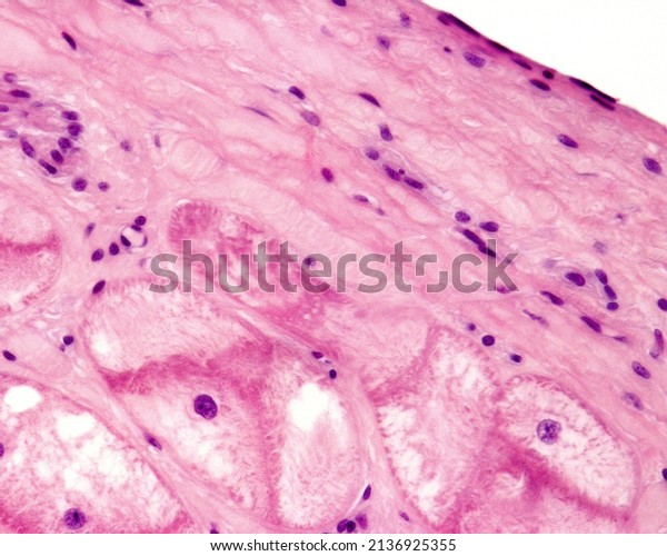 Heart. Purkinje fibers, part of the\
conducting system of the heart. They appear as large muscle fibres\
with central nucleus and few myofibrils located in the\
subendocardium, beneath the\
endocardium