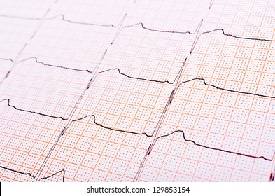 Heart Rhythm Chart For Background Usage