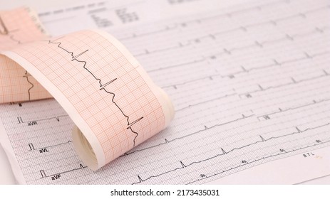 heart rhythm ekg note on paper doctors use to analyze heart disease treatment illustration on a white background - Shutterstock ID 2173435031