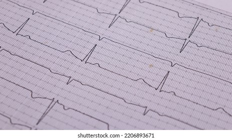 Heart Rhythm Ekg Note On Paper Doctors Use It To Analyze Heart Disease Treatments. Illustration On A White Background