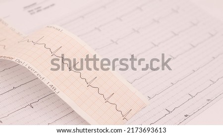 heart rhythm ekg note on paper doctors use to analyze heart disease treatment There is a syringe, a thermometer over it.