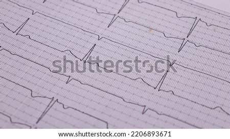 heart rhythm ekg note on paper Doctors use it to analyze heart disease treatments. illustration on a white background