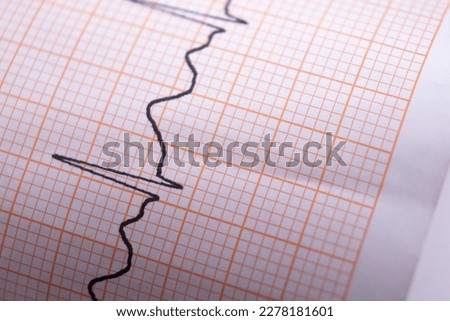 heart rhythm ekg note on paper Doctors use it to analyze heart disease treatments. illustration on a white background,macro