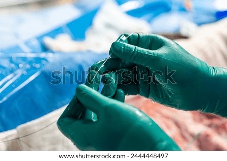 Heart stent placement process in operating room. Heart doctor inserting central venous catheter, Jugular venous catheterization. A central venous catheter is inserted into the jugular vena.