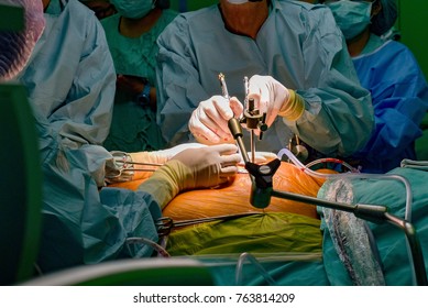 Heart Surgery Atmosphere Operating Room Stock Photo 763814209 ...