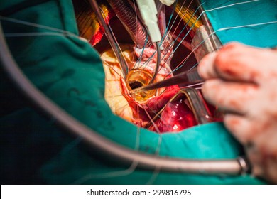 heart surgery wallpaper