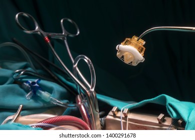 Heart Valve Prosthesis. Image Of Aortic Valve Implant During Open Heart Surgery.