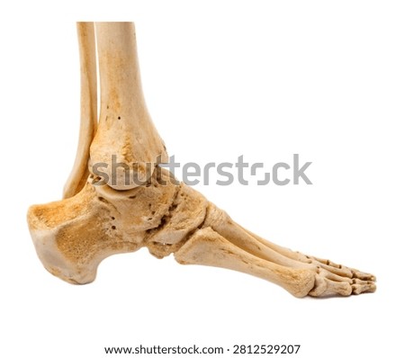 Heel Bone Calcaneus Heel Bone Displayed In Sid Isolated On White Background