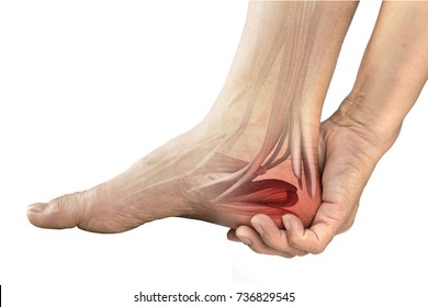 Heel Muscle Pain