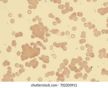 37 Hemagglutination Images, Stock Photos & Vectors | Shutterstock