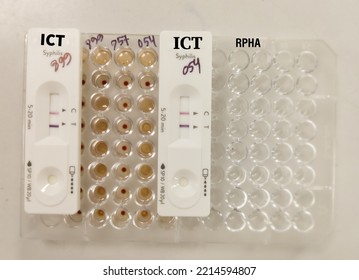 Hemagglutination Assay For T. Pallidum Antibodies. TPHA. RPHA Mathod Test Plate, Serology Testing Method In Medical Laboratory.