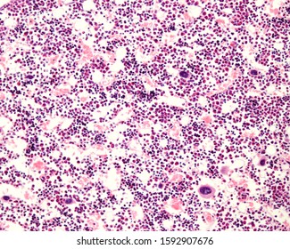 Hematopoietic Bone Marrow Red Marrow Vascular Stock Photo 1592907676 ...