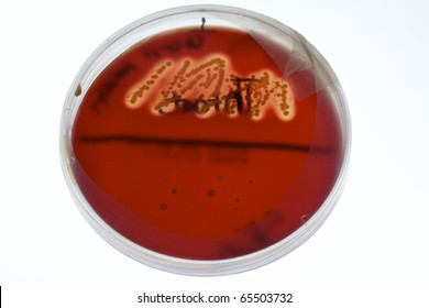 Hemolysis On Blood Agar Plate